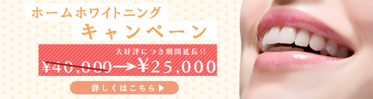ホワイトニングキャンペーン